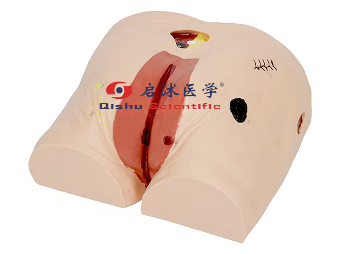 高級(jí)褥瘡護(hù)理模型